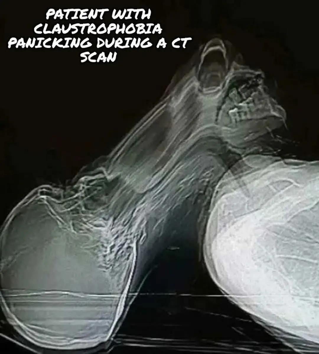 Panicking patient in CT scan